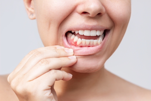 Periodontia